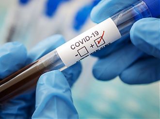 Лаборатория медицинского центра «Асклепий» проводит тестирование на Covid-19 на территории Международного аэропорта г.Владивосток
