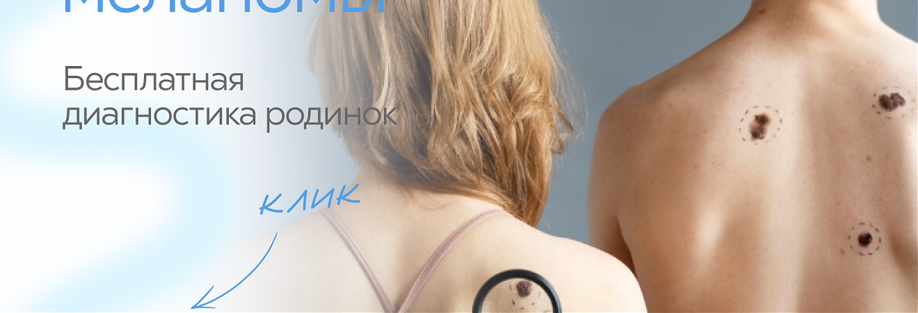 Обследуйте родинки-сохраните свою жизнь!
